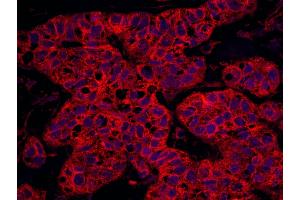 Immunohistochemistry (IHC) image for anti-Septin 9 (SEPT9) (AA 536-586) antibody (ABIN7453396)