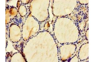 Immunohistochemistry of paraffin-embedded human thyroid tissue using ABIN7176080 at dilution of 1:100 (ZMAT4 antibody  (AA 1-153))