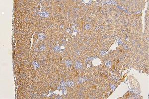 IHC analysis of SFRP1 using anti-SFRP1 antibody (ABIN6719484). (SFRP1 antibody)