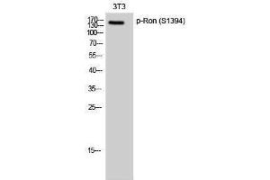 Western Blotting (WB) image for anti-Macrophage Stimulating 1 Receptor (C-Met-Related tyrosine Kinase) (MST1R) (pSer1394) antibody (ABIN3173035) (MST1R antibody  (pSer1394))