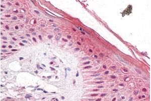ABIN184855 (5µg/ml) staining of paraffin embedded Human Skin. (PUF60 antibody  (C-Term))