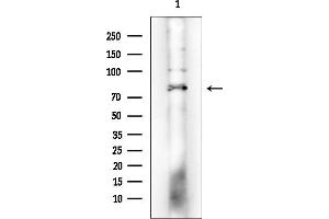 Western blot analysis of lysates from EC304 cells(heat-shock treatment), using CTNNAL1 Mouse Monoclonal Antibody at 1/1000 dilution.