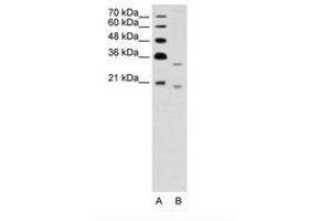 DNASE2B antibody  (AA 47-96)