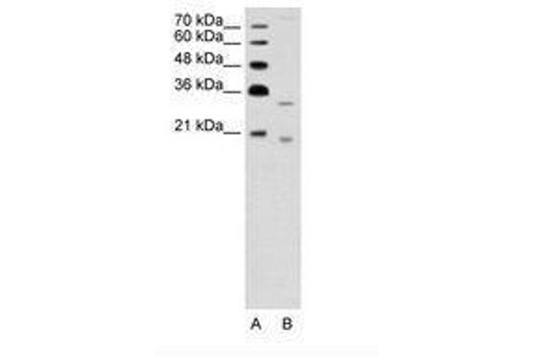 DNASE2B 抗体  (AA 47-96)