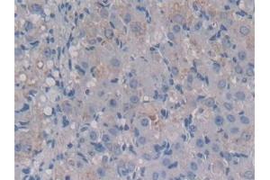 Detection of MCSF in Mouse Ovary Tissue using Polyclonal Antibody to Colony Stimulating Factor 1, Macrophage (MCSF) (M-CSF/CSF1 antibody  (AA 33-204))