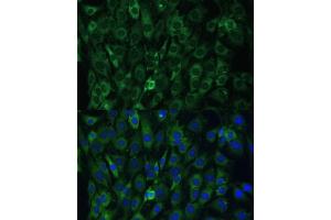 Immunofluorescence analysis of C6 cells using EIF3D antibody (ABIN6130833, ABIN6140057, ABIN6140058 and ABIN6221638) at dilution of 1:100. (EIF3D antibody  (AA 1-240))