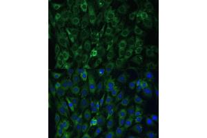 Immunofluorescence analysis of C6 cells using EIF3D antibody (ABIN6130833, ABIN6140057, ABIN6140058 and ABIN6221638) at dilution of 1:100.