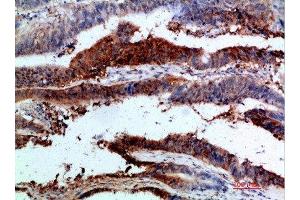 Immunohistochemistry (IHC) image for anti-Integrin alpha 1 (ITGA1) (AA 920-980) antibody (ABIN7189540)
