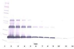Image no. 1 for anti-Tumor Necrosis Factor (Ligand) Superfamily, Member 11 (TNFSF11) antibody (ABIN465772) (RANKL antibody)