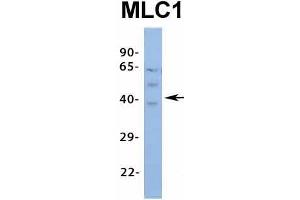 Host:  Rabbit  Target Name:  MLC1  Sample Type:  Human Fetal Spleen  Antibody Dilution:  1. (MLC1 antibody  (Middle Region))