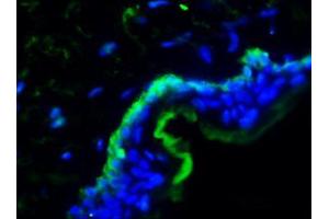 Image no. 1 for anti-Integrin, alpha 3 (ITGA3) (Cytoplasmic Domain) antibody (ABIN959430) (ITGA3 antibody  (Cytoplasmic Domain))