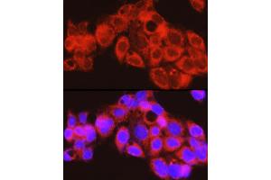 Immunofluorescence analysis of HepG2 cells using PYGL Rabbit pAb (ABIN6132277, ABIN6146525, ABIN6146526 and ABIN6222425) at dilution of 1:150 (40x lens). (PYGL antibody  (AA 1-280))