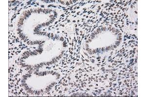 Image no. 1 for anti-TYRO3 Protein Tyrosine Kinase (TYRO3) antibody (ABIN1501607) (TYRO3 antibody)