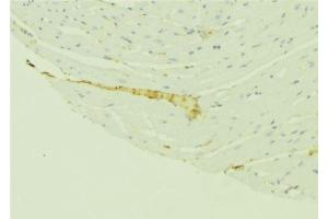 ABIN6276410 at 1/100 staining Mouse liver tissue by IHC-P. (VDAC1 antibody  (C-Term))