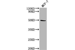 Western Blot Positive WB detected in: MCF-7 whole cell lysate All lanes: KLK11 antibody at 1:2000 Secondary Goat polyclonal to rabbit IgG at 1/50000 dilution Predicted band size: 32, 28, 34, 31 kDa Observed band size: 50 kDa