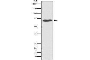 Western blot analysis of PDI expression in HeLa cell lysate.