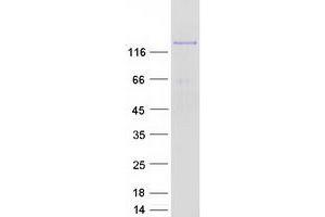 Validation with Western Blot (AGL Protein (Transcript Variant 4) (Myc-DYKDDDDK Tag))