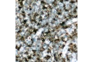 Immunohistochemical analysis of p47 phox (pS328) staining in human lymph node formalin fixed paraffin embedded tissue section. (NCF1 antibody  (C-Term, pSer328))