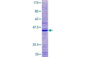 RPS18 Protein (AA 1-152) (GST tag)