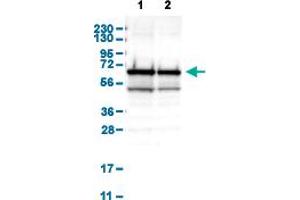Western Blot analysis of (1) human cell line RT-4, and (2) human cell line U-251MG sp. (METAP2 antibody  (AA 10-101))