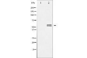 Western blot analysis of Lyn phosphorylation expression in H2O2 treated K562 whole cell lysates,The lane on the left is treated with the antigen-specific peptide. (LYN antibody  (pTyr507))