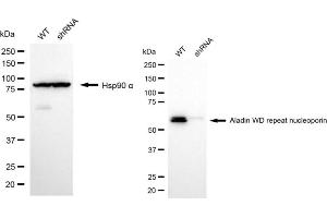 Western blotting analysis using aladin WD repeat nucleoporin antibody (ABIN7797447). (Adracalin antibody)