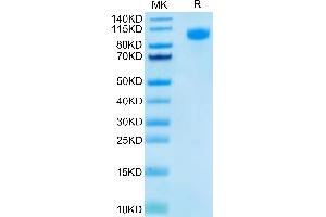 FITC-Labeled Human EGFR/HER1 on Tris-Bis PAGE under reduced condition.