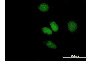 Immunofluorescence of purified MaxPab antibody to ATF2 on HeLa cell. (ATF2 antibody  (AA 1-209))