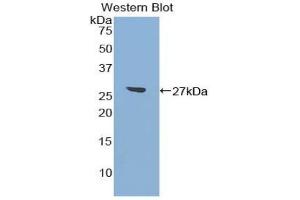 Detection of Recombinant ATF7, Mouse using Polyclonal Antibody to Activating Transcription Factor 7 (ATF7) (AFT7 antibody  (AA 50-270))