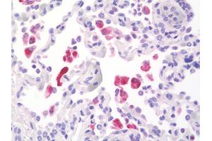 Anti-ACP5 / TRAP antibody IHC staining of human lung.