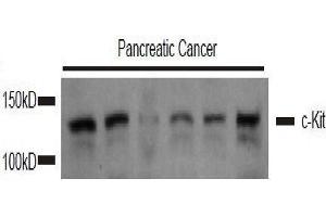 Image provided by the Free Sample Program. (KIT antibody  (AA 350-440))