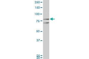 Western Blotting (WB) image for anti-Prospero Homeobox 1 (PROX1) (AA 638-737) antibody (ABIN519306)