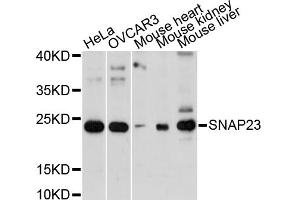 Western blot analysis of extracts of various cell lines, using SNAP23 antibody. (SNAP23 antibody)