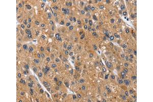 Immunohistochemistry (IHC) image for anti-Carcinoembryonic Antigen-Related Cell Adhesion Molecule 3 (CEACAM3) antibody (ABIN2427949)