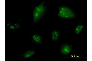 Immunofluorescence of monoclonal antibody to NCOA6 on HeLa cell. (NCOA6 antibody  (AA 1954-2063))