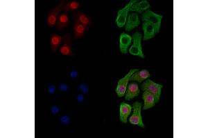 ABIN6266225 and ABIN6277496 staining Hela cells(heat shock treatment) by IF/ICC. (Histone 3 antibody  (H3K14me2))