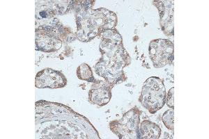 Immunohistochemistry of paraffin-embedded human placenta using PMEP antibody (6555) at dilution of 1:100 (40x lens). (PMEPA1 antibody  (AA 173-252))