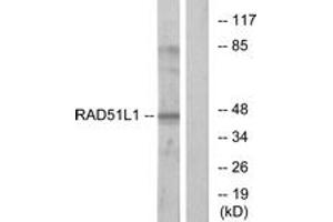 Western Blotting (WB) image for anti-RAD51 Homolog B (Rad51B) (AA 201-250) antibody (ABIN2890025) (RAD51 Homolog B antibody  (AA 201-250))