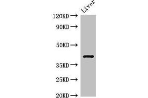 Western Blot Positive WB detected in: Rat liver tissue All lanes: TGDS antibody at 3 μg/mL Secondary Goat polyclonal to rabbit IgG at 1/50000 dilution Predicted band size: 41 kDa Observed band size: 41 kDa (TGDS antibody  (AA 143-305))