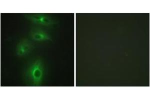 Immunofluorescence (IF) image for anti-Transmembrane Protease, Serine 3 (TMPRSS3) (AA 405-454) antibody (ABIN1533796)