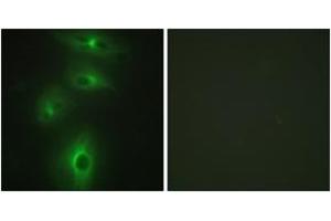 Immunofluorescence analysis of HeLa cells, using TMPRSS3 Antibody. (TMPRSS3 antibody  (AA 405-454))