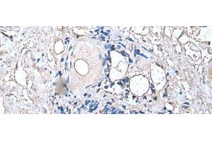 Immunohistochemistry (Paraffin-embedded Sections) (IHC (p)) image for anti-Protein Tyrosine Phosphatase Type IVA, Member 1 (PTP4A1) antibody (ABIN7245674)