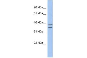 WB Suggested Anti-ZADH2 Antibody Titration: 0. (ZADH2 antibody  (N-Term))