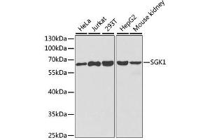 Western blot analysis of extracts of various cell lines, using SGK1 antibody. (SGK1 antibody  (AA 172-431))
