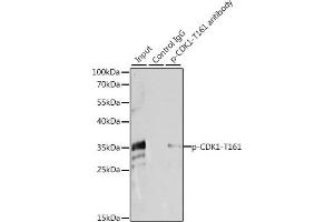 Immunoprecipitation analysis of 200 μg extracts of HeLa cells, using 3 μg Phospho-CDK1-T161 pAb (ABIN3020135, ABIN3020136, ABIN3020137, ABIN1681454 and ABIN6225511). (CDK1 antibody  (pThr161))