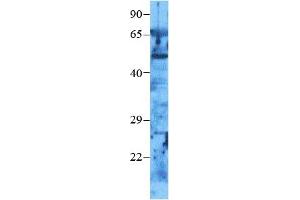 Western Blotting (WB) image for anti-Matrix Metalloproteinase 2 (MMP2) (C-Term) antibody (ABIN2792308)