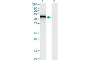 Western Blot analysis of SPP1 expression in transfected 293T cell line by SPP1 monoclonal antibody (M20), clone 4C4. (Osteopontin antibody  (AA 21-129))