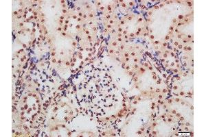 Formalin-fixed and paraffin embedded rat kidney labeled with Rabbit Anti-CDKN1A (Ser130) Polyclonal Antibody, Unconjugated  at 1:200 followed by conjugation to the secondary antibody and DAB staining (p21 antibody  (pSer130))