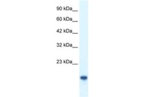 Western Blotting (WB) image for anti-C-Myc Binding Protein (MYCBP) antibody (ABIN2460299) (MYCBP antibody)