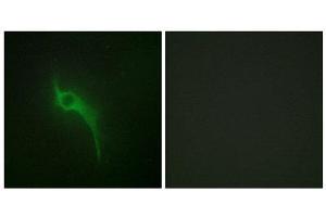Immunofluorescence (IF) image for anti-Collagen, Type V, alpha 1 (COL5A1) (Internal Region) antibody (ABIN1850288)
